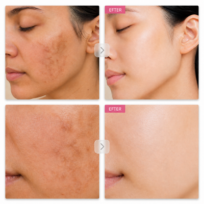 Arbutin 7% Brightening Cream