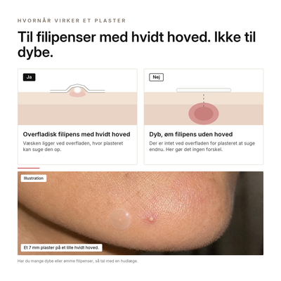 Hydrokolloid Akneplastre, fordele