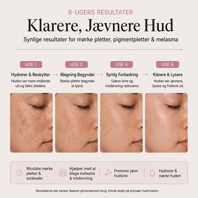 De fleste cremer bruger 2% Arbutin. Vi bruger 7.