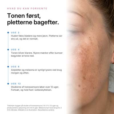 TXA Pigmentcreme, hvad du kan forvente
